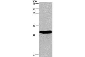 Western blot analysis of Mouse heart tissue, using FHL2 Polyclonal Antibody at dilution of 1:2400 (FHL2 antibody)