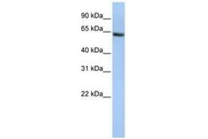 Image no. 1 for anti-Fanconi Anemia, Complementation Group E (FANCE) (AA 180-229) antibody (ABIN6741318) (FANCE antibody  (AA 180-229))