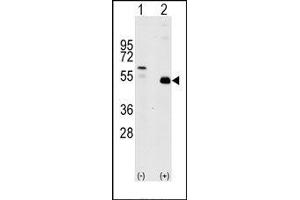Image no. 1 for anti-TNF Receptor-Associated Factor 2 (TRAF2) (C-Term) antibody (ABIN360166)