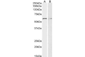 ABIN5539533 (2µg/ml) staining of HeLa (A) and K562 (B) lysates (35µg protein in RIPA buffer). (GPC1 antibody  (Internal Region))