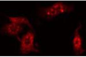 ABIN6274855 staining HeLa by IF/ICC. (Apolipoprotein F antibody  (C-Term))