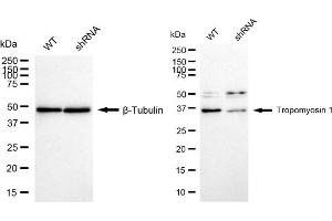 Western blotting analysis using Tropomyosin 1 antibody (ABIN7800651). (Recombinant Tropomyosin antibody)