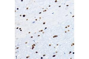 Immunohistochemistry of paraffin-embedded mouse brain using SOX10 Rabbit pAb (ABIN7270568) at dilution of 1:100 (40x lens). (SOX10 antibody  (AA 200-300))