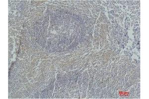 Immunohistochemical analysis of paraffin-embedded Human Tonsil Tissue using Active Caspase-3 Monoclonal Antibody. (Caspase 3 antibody)