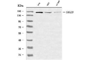 Western blot analysis of DHX29 using anti-DHX29 antibody (ABIN7602033).