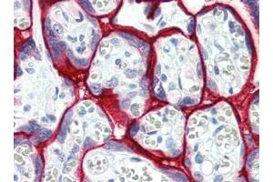 Human Placenta (formalin-fixed, paraffin-embedded) stained with SDC1at 15 µg/ml followed by biotinylated goat anti-rabbit IgG secondary antibody, alkaline phosphatase-streptavidin and chromogen. (Syndecan 1 antibody  (AA 18-218))