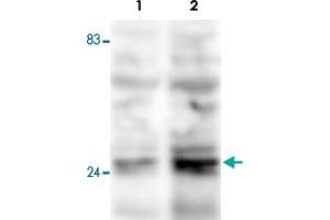 Western blot was performed on whole cell lysates from mouse fibroblasts (Lane 1, NIH/3T3) and embryonic stem cells (Lane 2, E14Tg2a) with Fkbp3 polyclonal antibody , diluted 1 : 500 in BSA/PBS-Tween. (FKBP3 antibody)