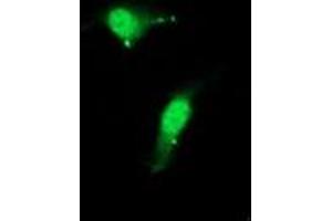 Image no. 3 for anti-Cystatin C (CST3) antibody (ABIN1497755) (CST3 antibody)