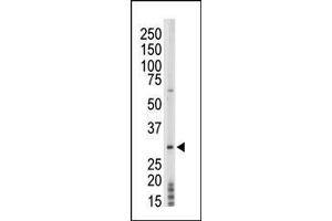 The anti-PRPK Pab (ABIN392682 and ABIN2842173) is used in Western blot to detect PRPK in mouse thymus tissue lysate. (TP53RK antibody  (AA 220-249))