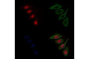 ABIN6263168 and ABIN6272598 staining Hela cells by IF/ICC. (MCM8 antibody  (C-Term))