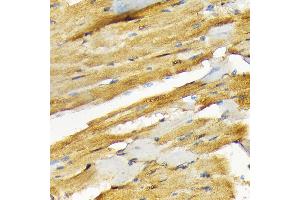 Immunohistochemistry of paraffin-embedded rat heart using COPS3 Rabbit mAb (ABIN7266498) at dilution of 1:100 (40x lens). (COPS3 antibody)