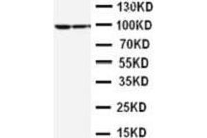 Anti-STAT1 antibody, Western blotting Lane 1: MCF-7 Cell Lysate Lane 2: HELA Cell Lysate (STAT1 antibody  (Middle Region))