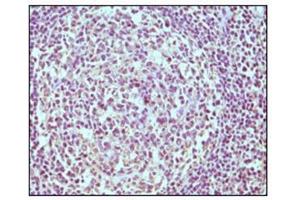 Immunohistochemistry (IHC) image for anti-CD19 Molecule (CD19) antibody (ABIN1105970) (CD19 antibody)