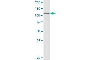 HNRNPUL1 MaxPab rabbit polyclonal antibody. (HNRNPUL1 antibody  (AA 1-804))