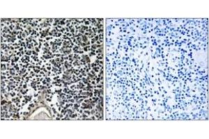 Immunohistochemistry analysis of paraffin-embedded human thymus gland, using ABCB7 Antibody. (ABCB7 antibody  (AA 691-740))