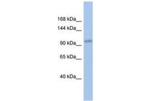 Image no. 1 for anti-DEAD (Asp-Glu-Ala-Asp) Box Polypeptide 24 (DDX24) (C-Term) antibody (ABIN6742691) (DDX24 antibody  (C-Term))