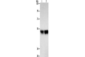 Western blot analysis of Hela cells A431 cells using ZFYVE19 Polyclonal Antibody at dilution of 1:500 (ZFYVE19 antibody)