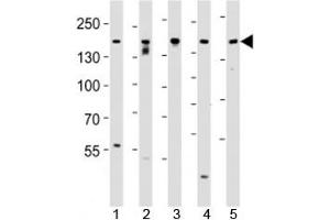 Western blot analysis of lysate from SH-SY5Y, MCF-7, PC3, LNCaP, HeLa, cell line (left to right) using Tuberin antibody at 1:1000 for each lane.