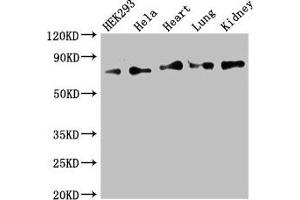 Western Blot Positive WB detected in: HEK293 whole cell lysate, Hela whole cell lysate, Mouse heart tissue, Mouse lung tissue, Mouse kidney tissue All lanes: FOXK1 antibody at 2.