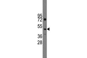 Western blot analysis of Ihh antibody and HL-60 lysate (Indian Hedgehog antibody  (AA 169-200))