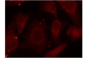 Image no. 1 for anti-Neurofibromin 2 (NF2) (pSer518) antibody (ABIN197028) (Merlin antibody  (pSer518))
