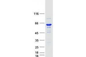 Validation with Western Blot (GCK Protein (Transcript Variant 2) (Myc-DYKDDDDK Tag))