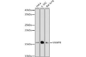 Western blot analysis of extracts of various cell lines, using V antibody (ABIN7271317) at 1:1000 dilution. (VAMP8 antibody)
