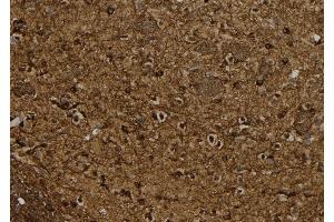 ABIN6267084 at 1/100 staining Rat brain tissue by IHC-P. (BTK antibody  (pTyr551))