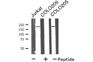 Western blot analysis of extracts from Jurkat/COLO205 cells, using MRCKa antibody. (CDC42BPA antibody  (Internal Region))