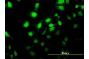 Immunofluorescence of monoclonal antibody to MKNK2 on HeLa cell. (MKNK2 antibody  (AA 1-158))