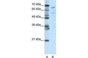 Western Blotting (WB) image for anti-TAF6-Like RNA Polymerase II, P300/CBP-Associated Factor (PCAF)-Associated Factor, 65kDa (TAF6L) antibody (ABIN2461793)