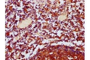 IHC image of ABIN7150474 diluted at 1:400 and staining in paraffin-embedded human lymph node tissue performed on a Leica BondTM system. (POLRMT antibody  (AA 282-405))