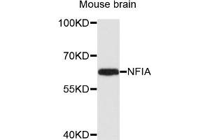 Western blot analysis of extracts of mouse brain cells, using NFIA antibody. (NFIA antibody)