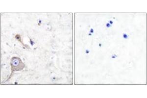 Immunohistochemistry analysis of paraffin-embedded human brain tissue, using S100 A1 Antibody. (S100A1 antibody  (AA 10-59))