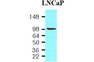 Western blot analysis: Cell lysates of LNCaP(30ug) were resolved by SDS-PAGE, transferred to NC membrane and probed with anti-human PSMA (1:1,000). (PSMA antibody)