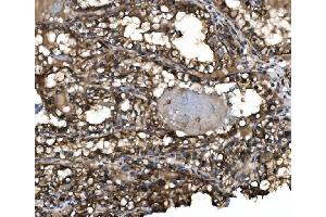 IHC analysis of Claudin 3/CLDN3 using anti-Claudin 3/CLDN3 antibody (ABIN7599626).