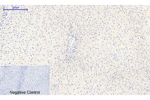 Immunohistochemical analysis of paraffin-embedded human liver tissue.