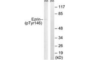 Western blot analysis of extracts from 293 cells treated with UV 15', using Ezrin (Phospho-Tyr146) Antibody.