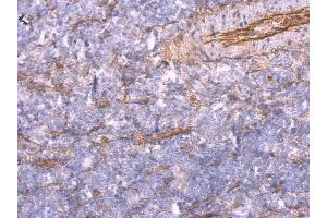 Immunohistochemistry (IHC) image for anti-TNFAIP3 Interacting Protein 2 (TNIP2) (Center) antibody (ABIN2854507)
