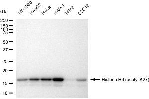 Western blotting analysis using Histone H3 (acetyl K27) antibody (ABIN7798971).