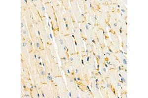 Immunohistochemistry of paraffin embedded mouse heart using CDH19 (ABIN7073258) at dilution of 1:500 (400x lens)