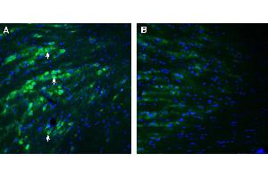 Expression of PACC1 in mouse reticular thalamic nucleus. (PACC1 (AA 95-110), (Extracellular) antibody)
