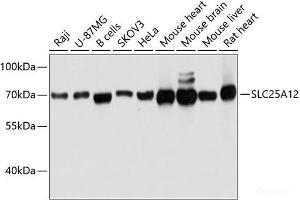 Western blot analysis of extracts of various cell lines using SLC25A12 Polyclonal Antibody at dilution of 1:3000. (SLC25A12 antibody)