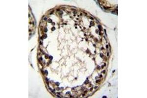 Immunohistochemistry analysis in formalin fixed and paraffin embedded human testis tissue reacted with OTUD1 Antibody (Center) followed which was peroxidase conjugated to the secondary antibody and followed by DAB staining.