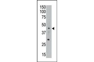 The anti-CEM15 Pab (ABIN388141 and ABIN2846472) is used in Western blot to detect CEM15 in A549 cell lysate. (APOBEC3G antibody  (AA 118-148))