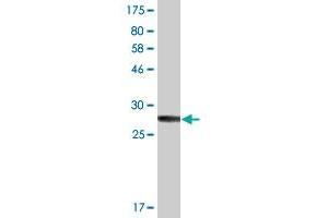 Western Blot detection against Immunogen (34. (Cathepsin H antibody  (AA 157-235))