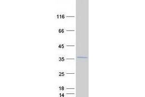 Western Blotting (WB) image for Ribosomal Protein L8 (RPL8) (Transcript Variant 2) protein (Myc-DYKDDDDK Tag) (ABIN2731150)