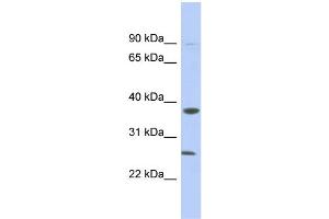 WB Suggested Anti-MYD88 Antibody Titration: 0. (MYD88 antibody  (N-Term))