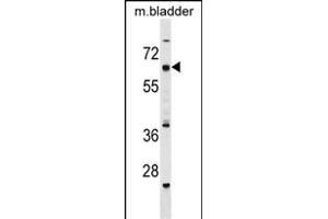 CECR6 antibody  (C-Term)
