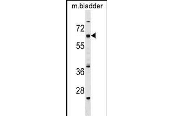 CECR6 antibody  (C-Term)